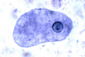 Disenteria amoeba е прост патоген на сериозно заболяване